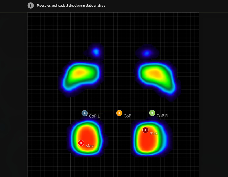 Foba Motion